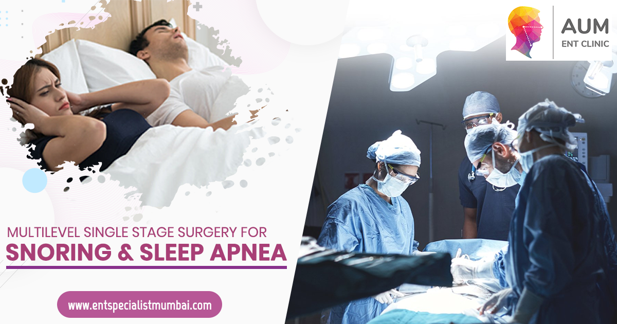 Multilevel Single Stage Surgery For Snoring and Sleep Apnea