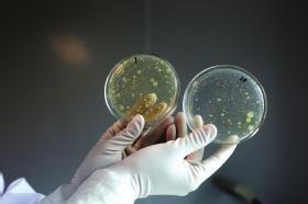 Can Hot Tubs Make You Sick