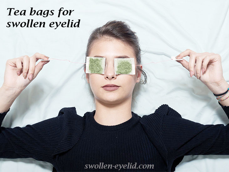 How to Treat Swollen Eyelid After Lash Lift Eyelash Extensions?