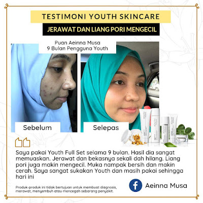 Testimoni Youth Skincare Untuk Jerawat