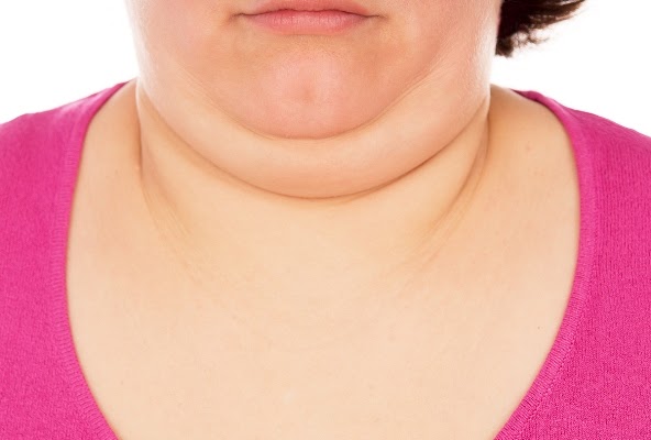 How to Lose a Double Chin with Neck Roll Exercises: