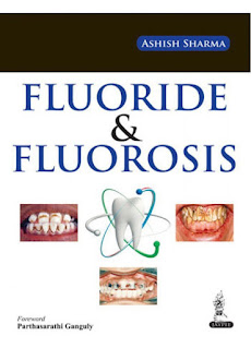 Fluoride and Fluorosis A Research Review by Ashish Sharma