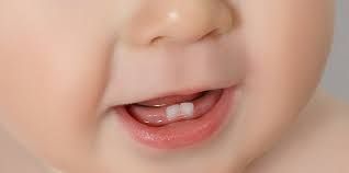 बच्चे के दांत निकलना,  जरूरी बातें | If the child’s teeth are coming out