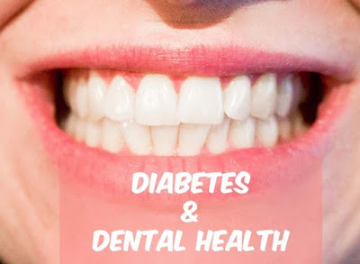 Mối quan hệ răng nướu và cách bệnh khác Rang-nuou-va-cac-benh-lien-quan