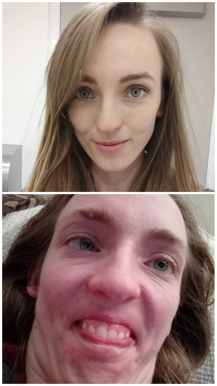 некрасивое выражение лица