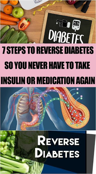 Steps To Reverse Type-2 Diabetes So You Never Have To Take Insulin Or Medication Again