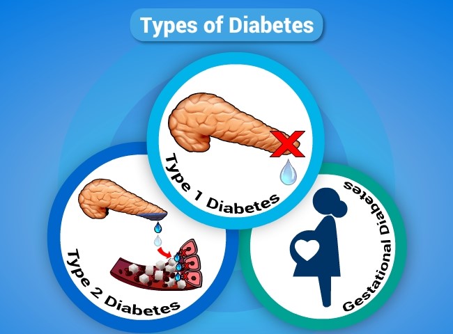Ejercicio en ayunas diabetes