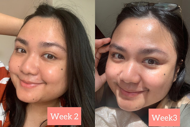 AIRNDERM SKINCARE REVIEW MENCEGAH MASKNE AIRNDERM SKINCARE REVIEW MENCEGAH MASKNE