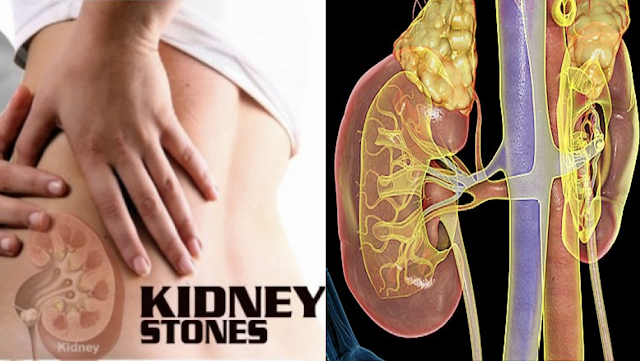Most Common Daily Harmful Habits That Can Actually Damage Your Kidneys