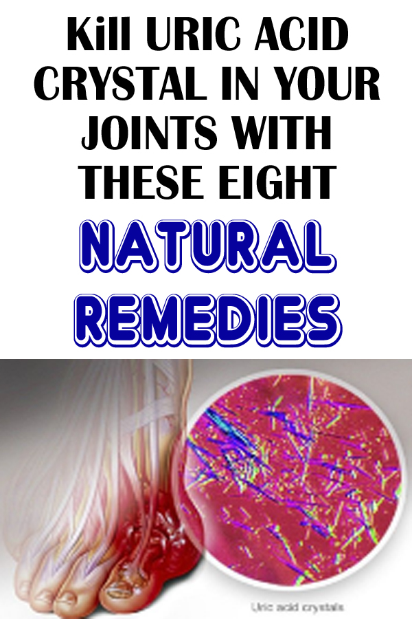 Kill URIC ACID CRYSTAL IN YOUR JOINTS WITH THESE EIGHT NATURAL REMEDIES