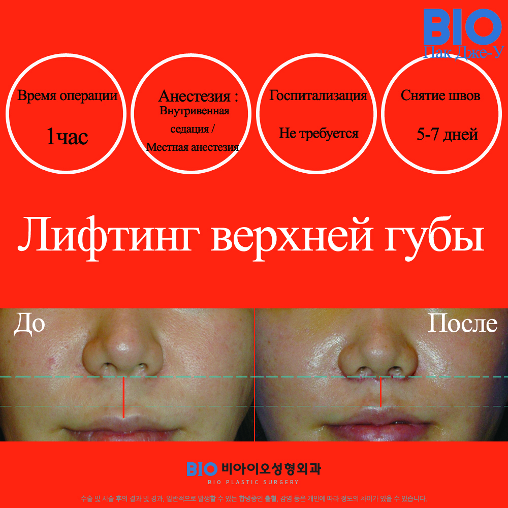 биос пластическая хирургия