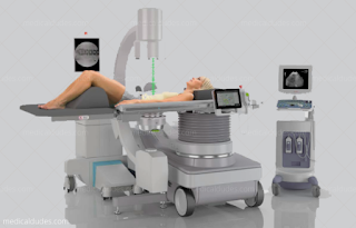 Extracorporeal Shock Wave Lithotripsy