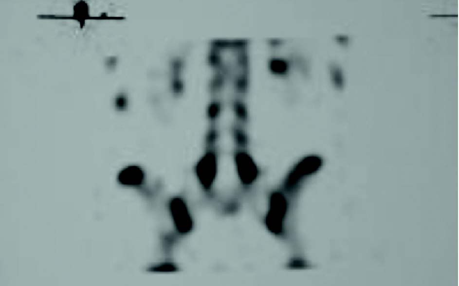 e thesis medicine spine The effect of osteopathic manual therapy (ie, spinal manipulation) in patients with chronic and subchronic back pain is largely unknown, and its use in such patients is controversial nevertheless, manual therapy is a frequently used method of treatment in this group of patients we performed a. e thesis medicine spine The effect of osteopathic manual therapy (ie, spinal manipulation) in patients with chronic and subchronic back pain is largely unknown, and its use in such patients is controversial nevertheless, manual therapy is a frequently used method of treatment in this group of patients we performed a.