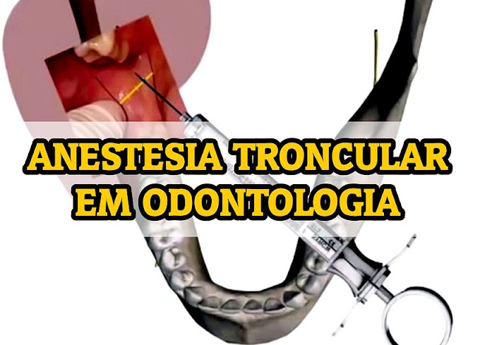 ANESTESIA Troncular em Odontologia