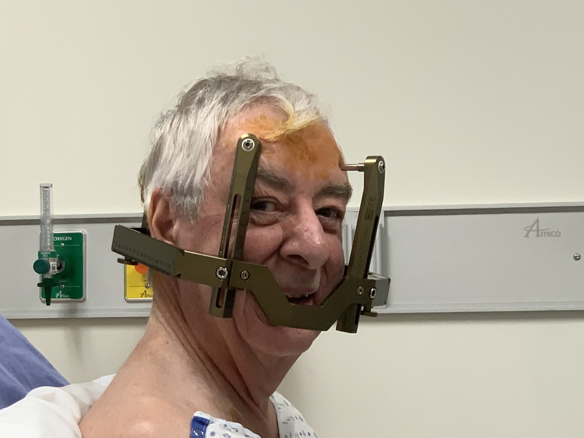 Chemo and Gamma Knife