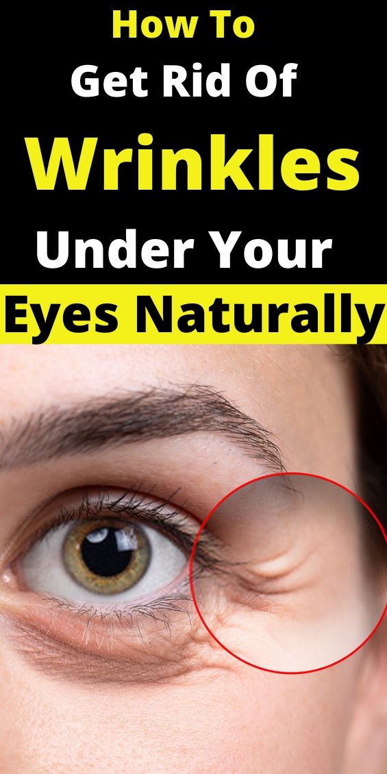 How To Get Rid Of Wrinkles Under Your Eyes Naturally SKINCARE