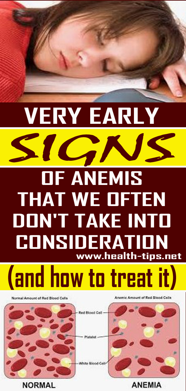 7 Signs of Anemia That You May Not Be Aware Of And How To Treat It