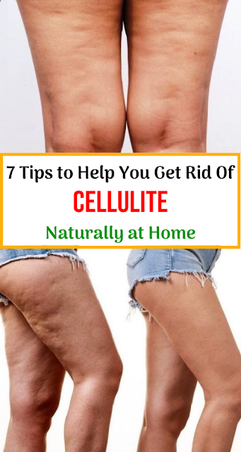 Let Start Slim Today Tips To Help You Get Rid Of Cellulite Naturally At Home