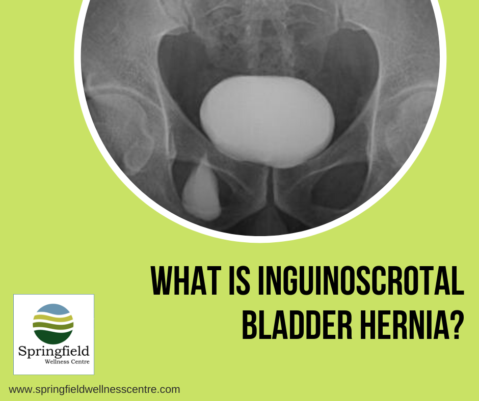 Hernia Surgery in Chennai What is inguinoscrotal bladder hernia?