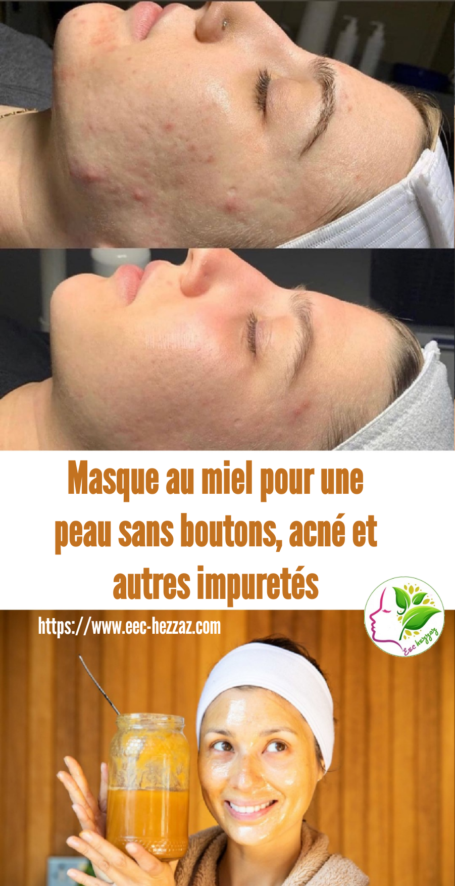 Masque au miel pour une peau sans boutons, acné et autres impuretés