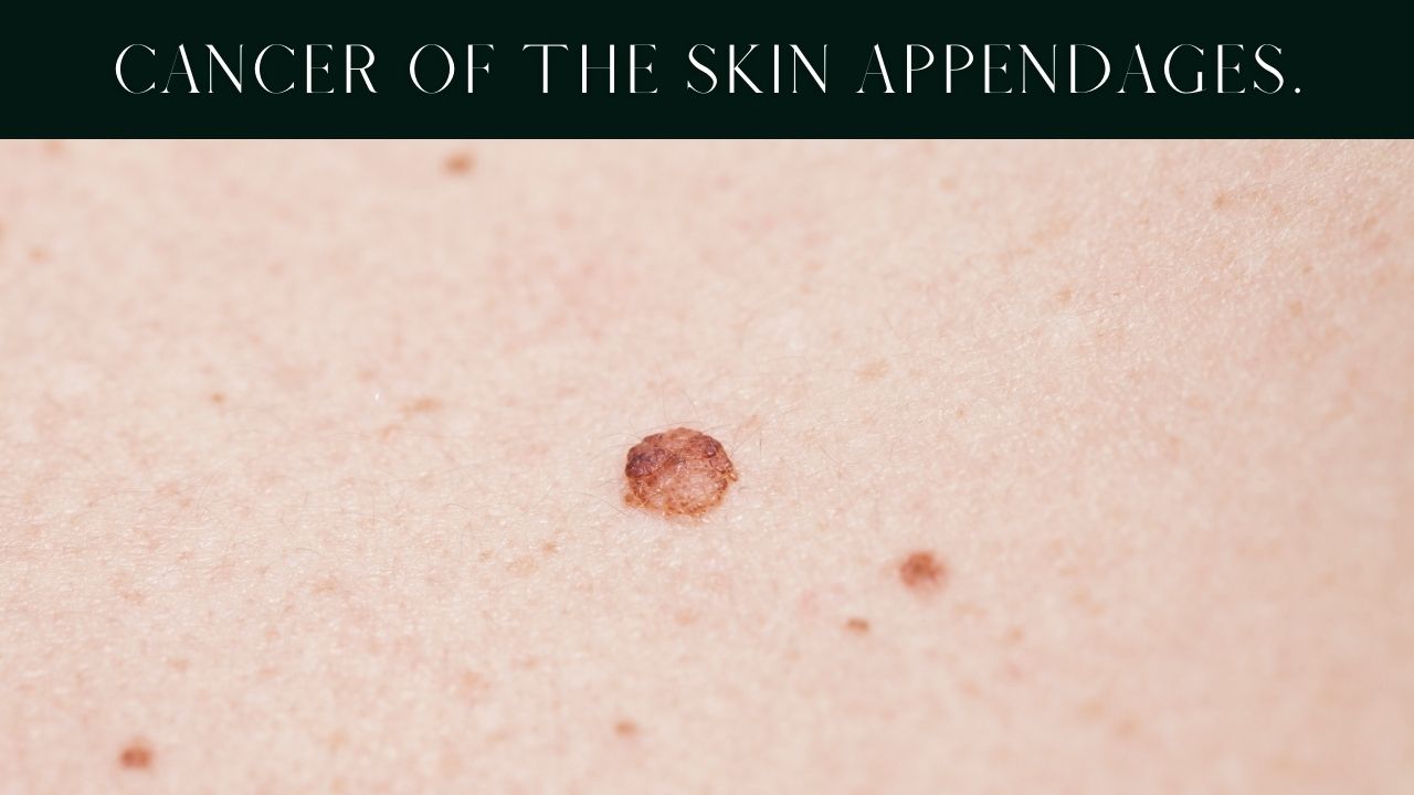 skin-cancer-types- causes-symptoms-pictures skin-cancer-types- causes-symptoms-pictures