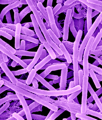 Ciri Bakteri Bacillus anthracis