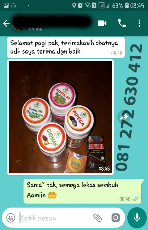 Testimoni Obat Kutil Kelamin De Nature