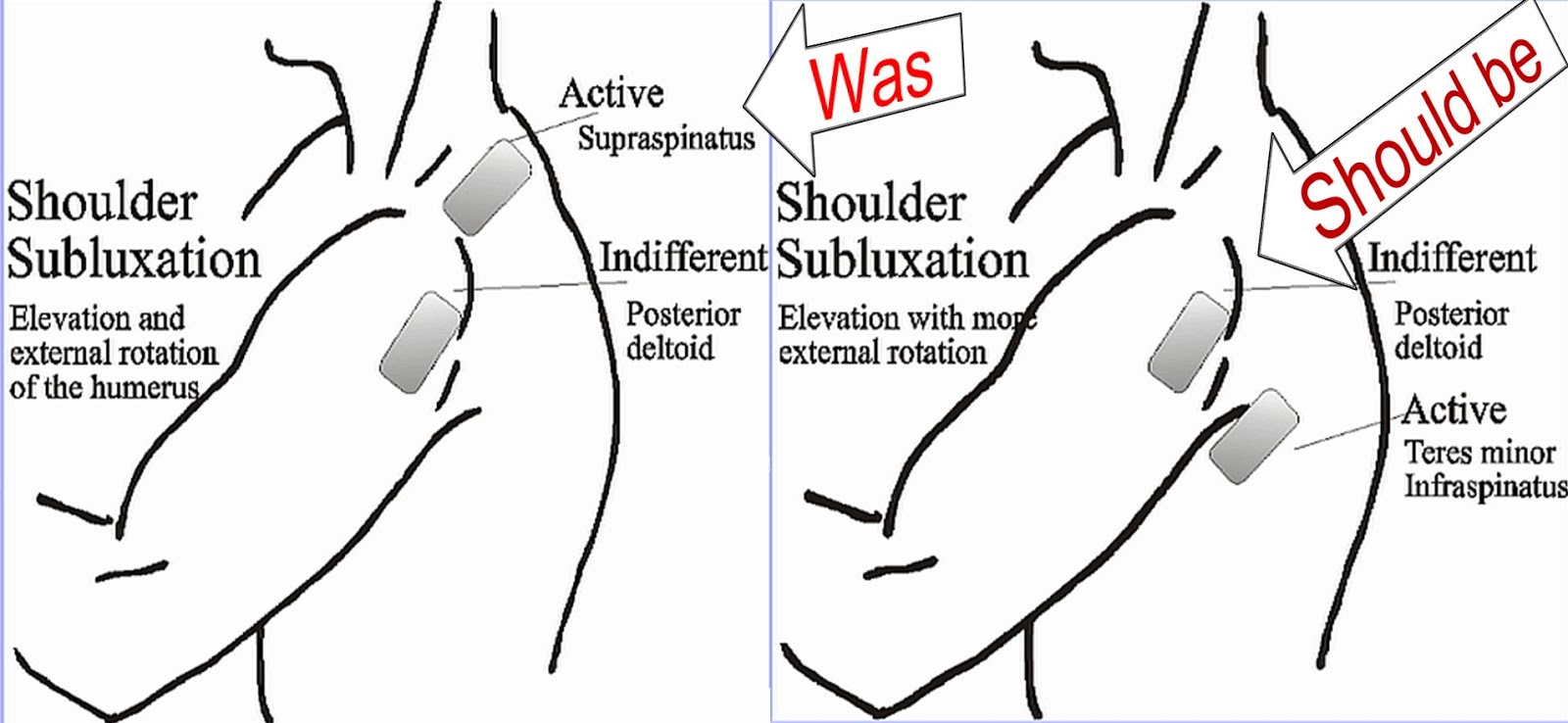 Stronger After Stroke Blog (THE STROKE RECOVERY BLOG)
