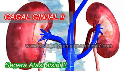 Penyebab Gagal Ginjal & Obat Gagal Ginjal Alami, Ampuh dan Aman Penyebab Gagal Ginjal & Obat Gagal Ginjal Alami, Ampuh dan Aman