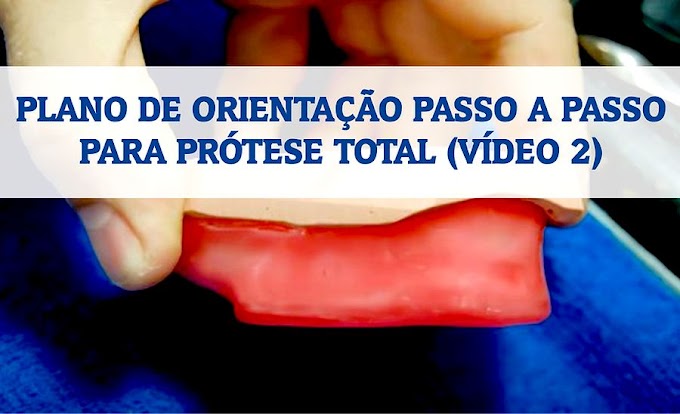 PRÓTESE TOTAL: Plano de orientação passo a passo (VÍDEO 2)