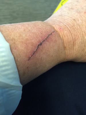 dog scratch on arm