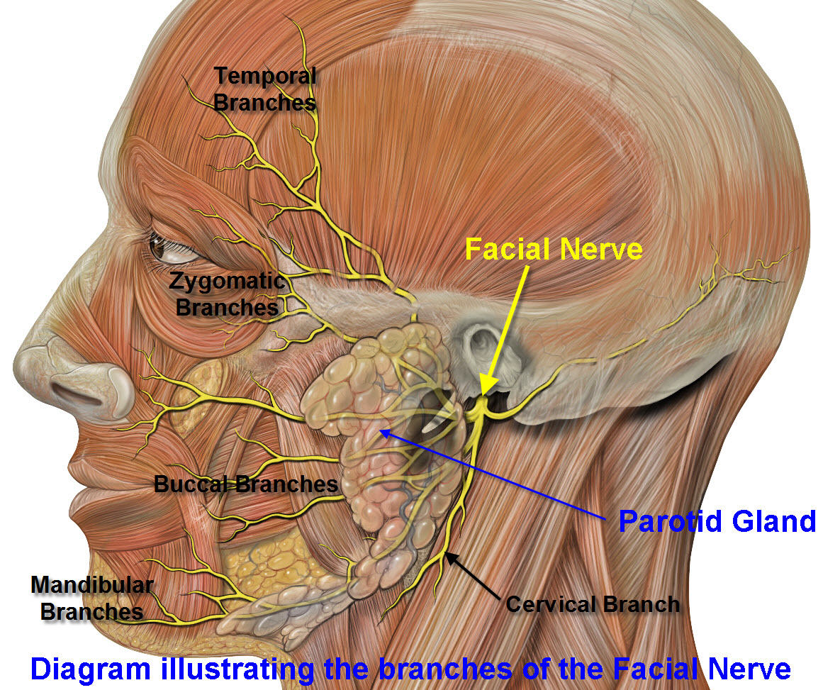 Facial Nerve Tumor 75