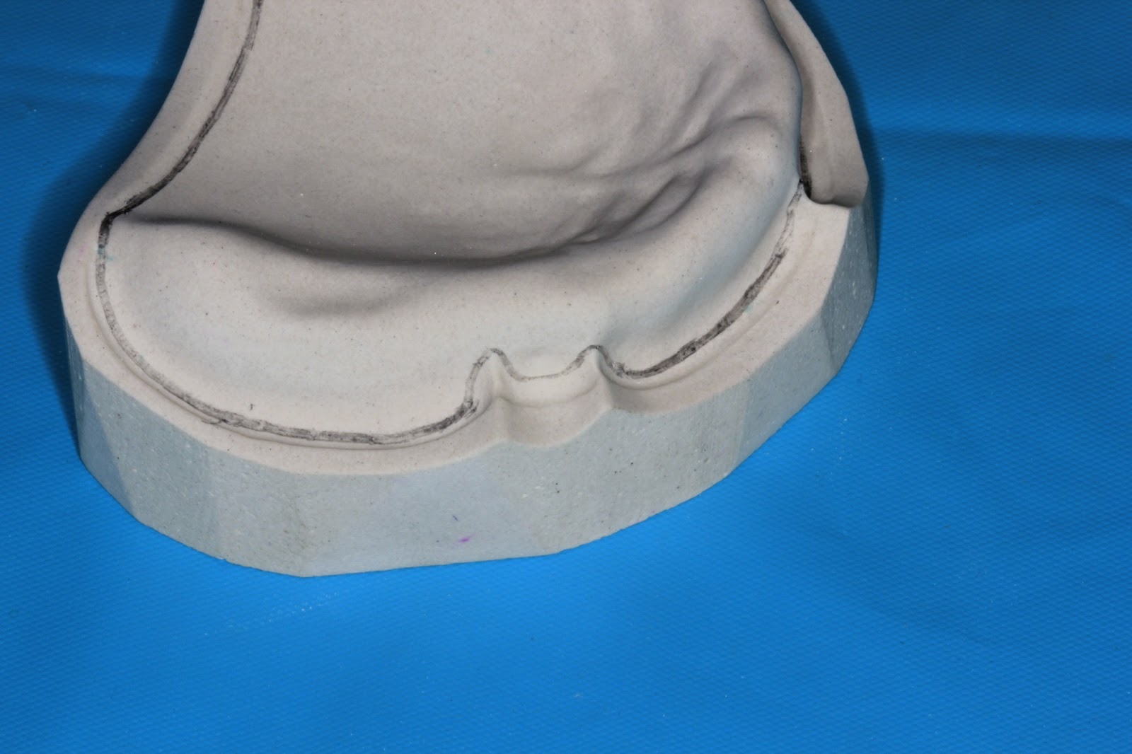 Understanding Prosthodontics Tagore Dental College & HospitalBy