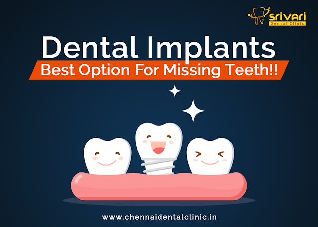 affordable dental implants in chennai