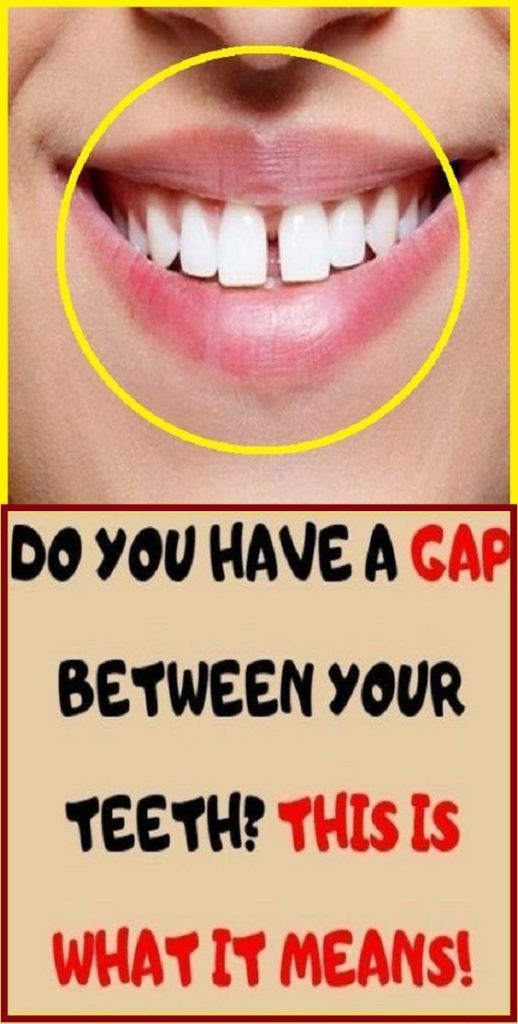 gap teeth between means change facts take health