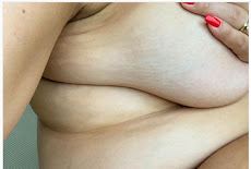 Ashley Graham praised for showing her "real" pregnancy body - وأشادت آشلي جراهام تبين  جسمها بعد الحمل