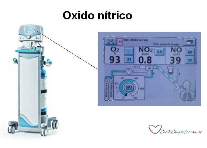 UCIFORMA PUESTA EN MARCHA TERAPIA INOmax DSIR