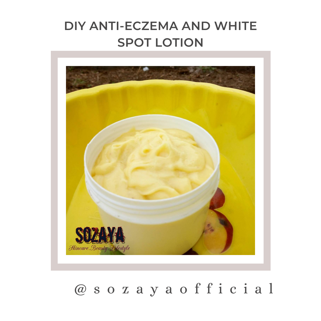 HOW TO GET RID OF WHITE SPOTS ON THE BODY SOZAYA how-to-get-rid-of-white-spots-on-the-body-sozaya