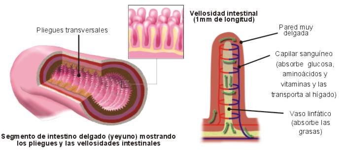 Crecimiento bacteriano excesivo en el intestino delgado