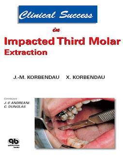 Clinical Success in Impacted Third Molar Extraction