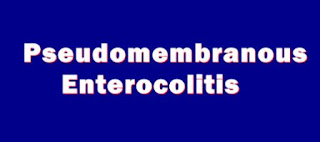 Pseudomembranous Enterocolitis