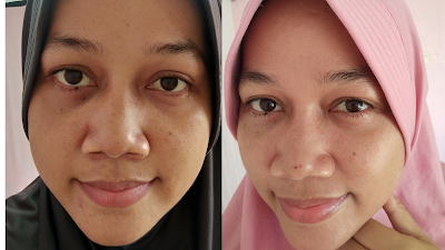 testimoni setelah menggunakan serum scarlett brightly ever after