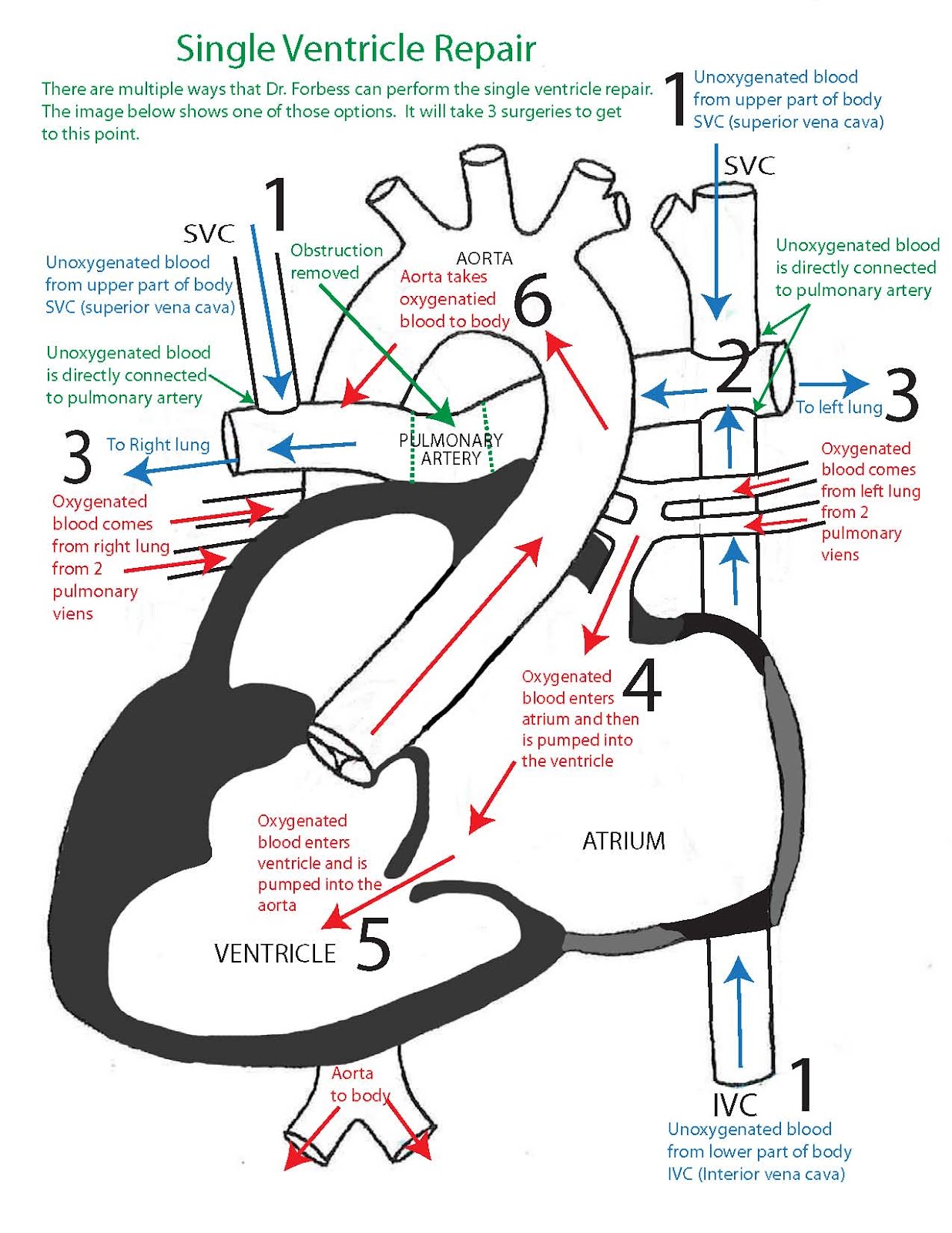 Kaleb Prinz: KALEB'S HEART CONDITION