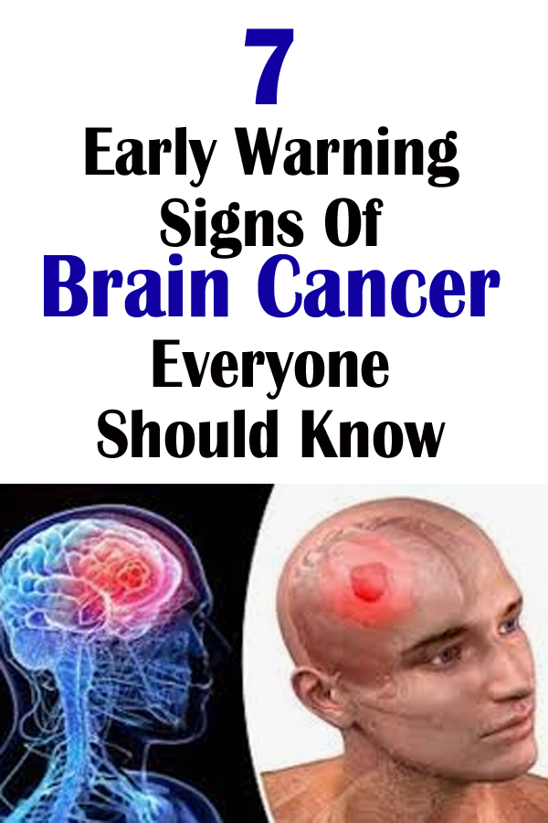 7 Early Warning Signs Of Brain Cancer Everyone Should Know