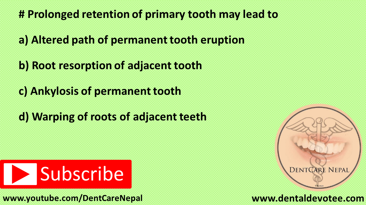 Dentosphere World of Dentistry Prolonged retention of primary tooth