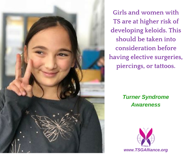 My Turner Syndrome Journey ABOUT TURNER SYNDROME