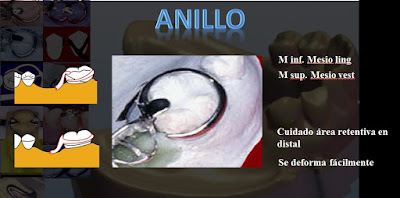 Seminario de Tecnología en Educación: PRÓTESIS PARCIAL REMOVIBLE : Parte 1