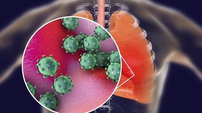 Έλληνας Καθηγητής του MIT: Ο κορονοϊός μπορεί να αφήνει ακόμη και μόνιμες βλάβες στους πνεύμονες