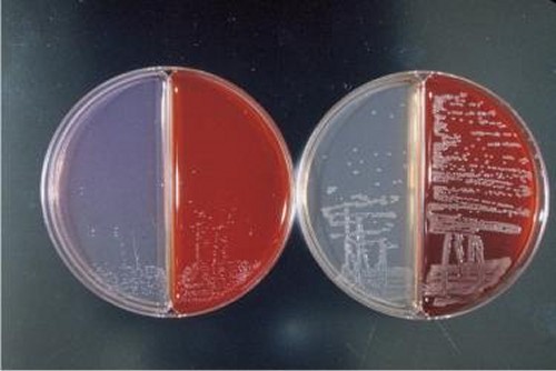 BORDETELLA SPECIES