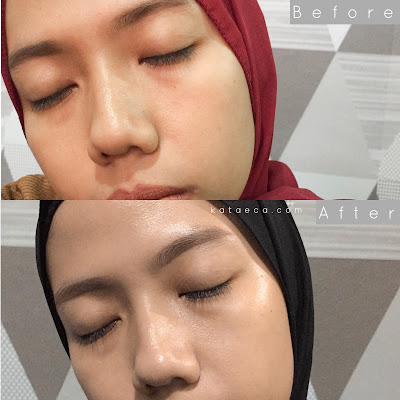 before after serum scarlett